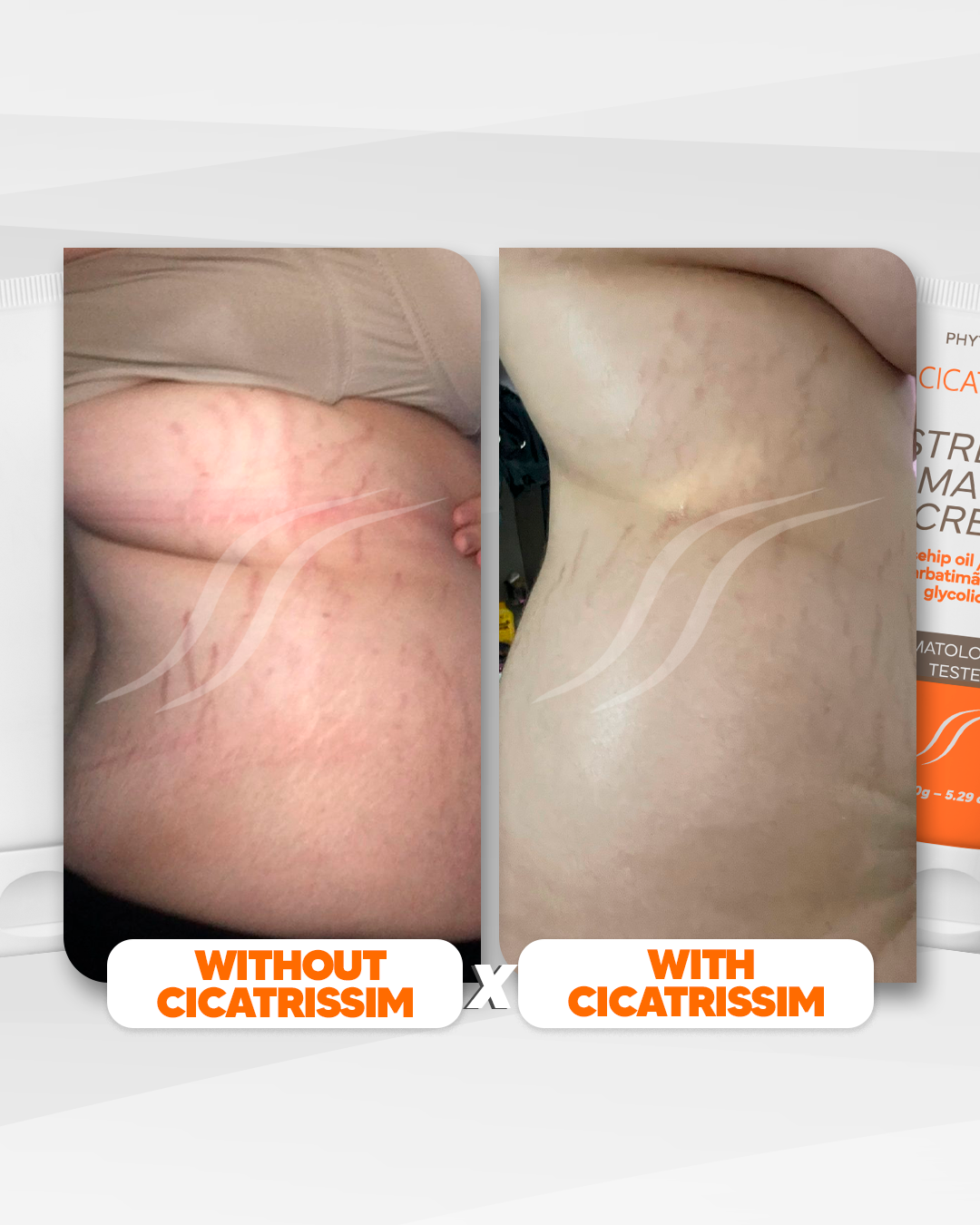 Cicatrissim Stretch Mark Cream - 4-Pack Bundle