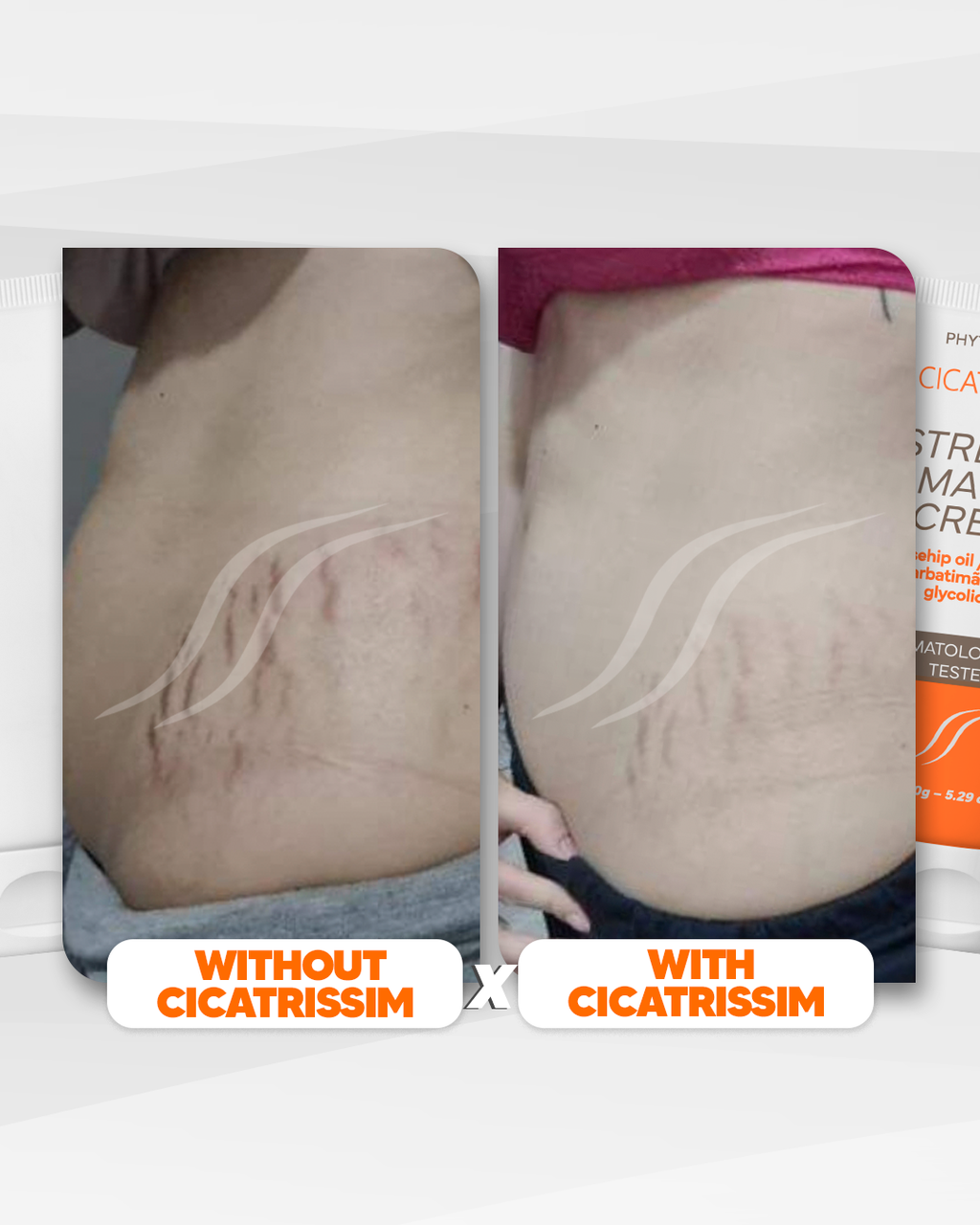 Cicatrissim Stretch Mark Cream - 2-Pack Bundle