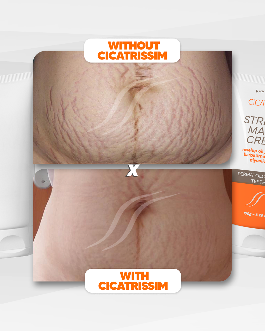 Cicatrissim Stretch Mark Cream - 2-Pack Bundle
