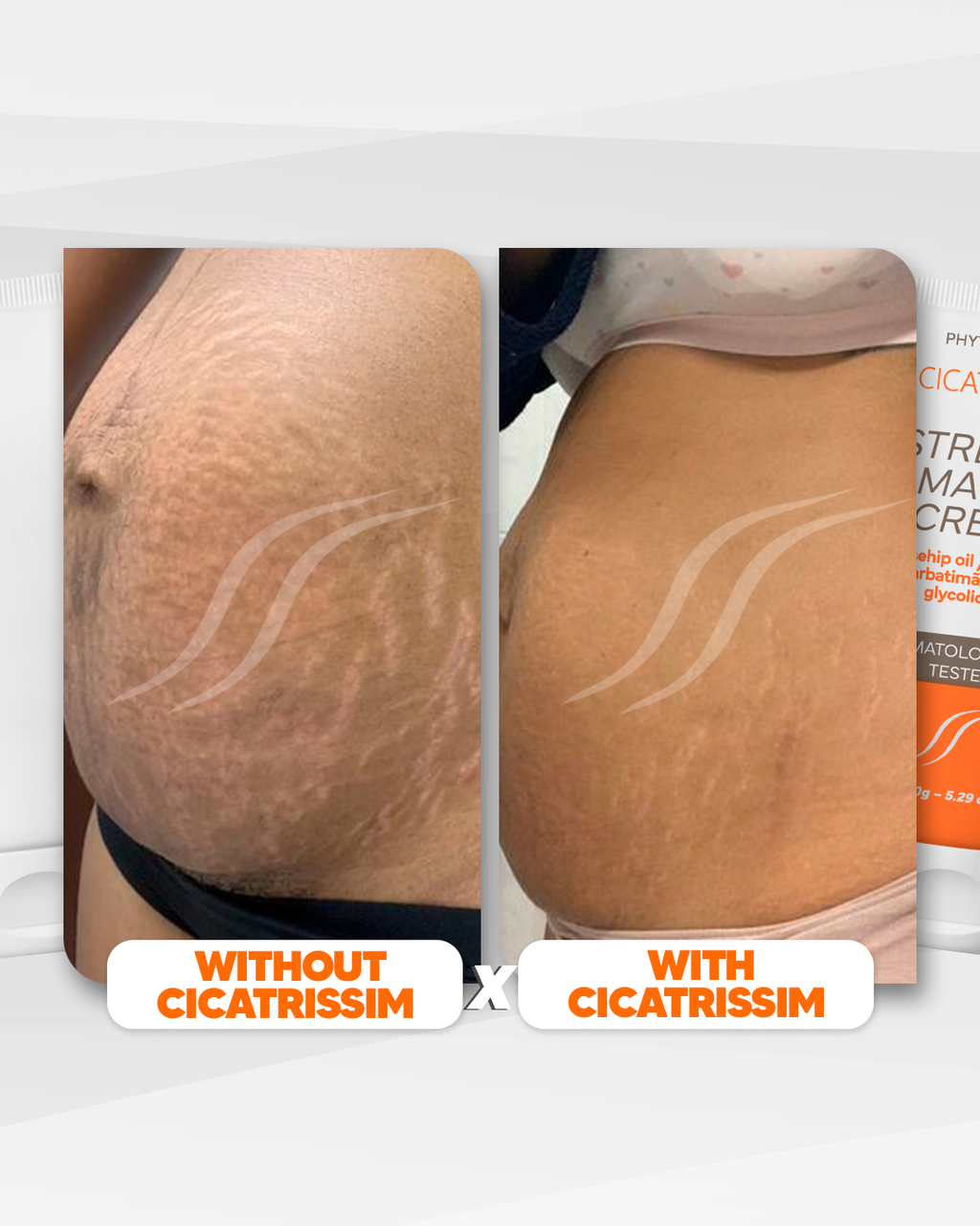 Cicatrissim Stretch Mark Cream - 2-Pack Bundle