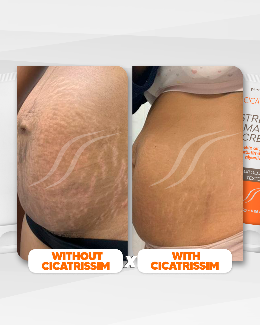 Cicatrissim Stretch Mark Cream - 2-Pack Bundle