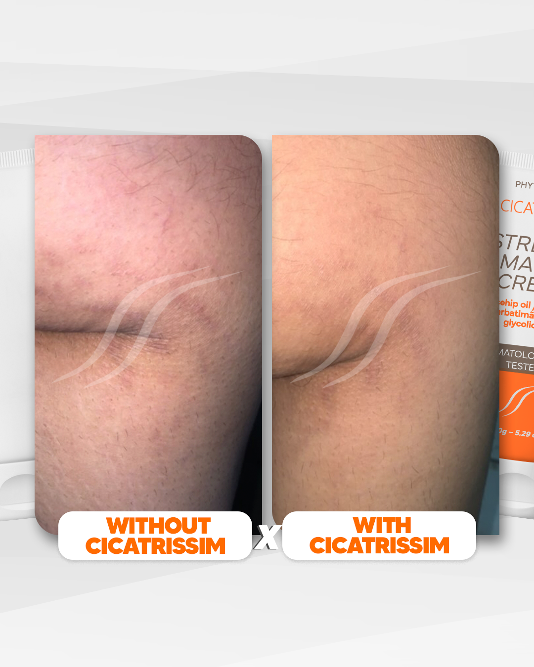 Cicatrissim Stretch Mark Cream - 4-Pack Bundle