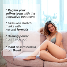 Load image into Gallery viewer, CicatrissimRed - RED Stretch Marks Cream
